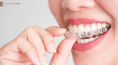 Desvendando o Sorriso Perfeito: As Vantagens do Invisalign