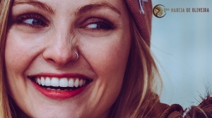 Clareamento Dental