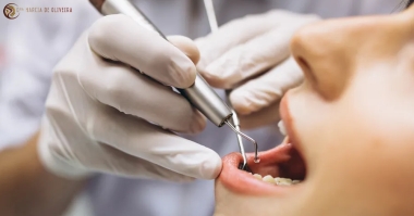 Endodontia Regenerativa: Uma Abordagem Inovadora para a Preservação Dentária