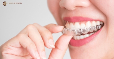 Desvendando o Sorriso Perfeito: As Vantagens do Invisalign